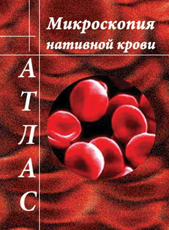 атлас микроскопии нативной крови